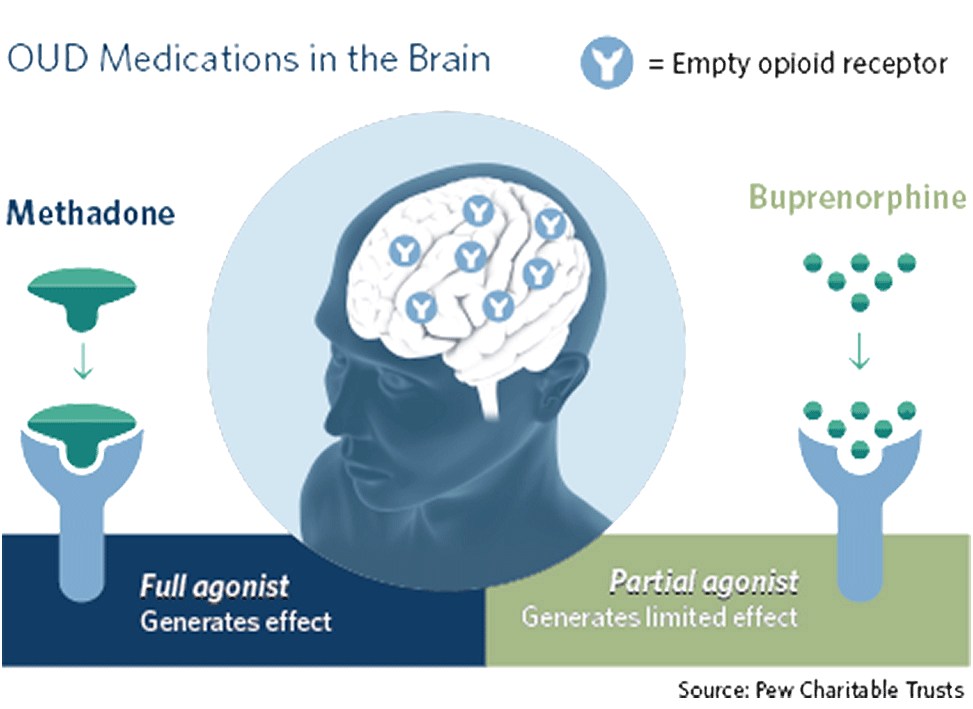 Illustration comparing the full agonist effect of methadone to the partial agonist effect of buprenorphine on opioid receptors in the brain.